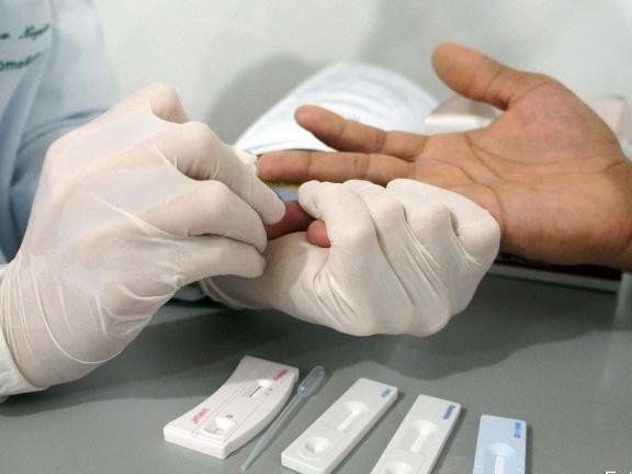 Registro de infecção por Sífilis reduz em 17% em Mato Grosso
