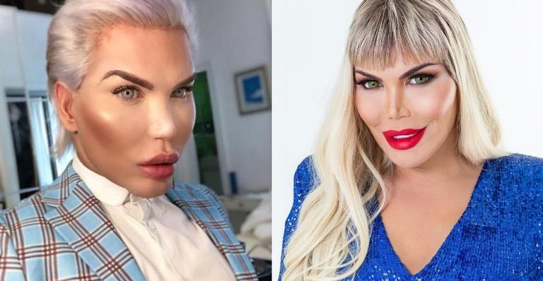 Ex-Ken Humano é chamado de “monstro” por médico durante programa de TV e não deixa barato