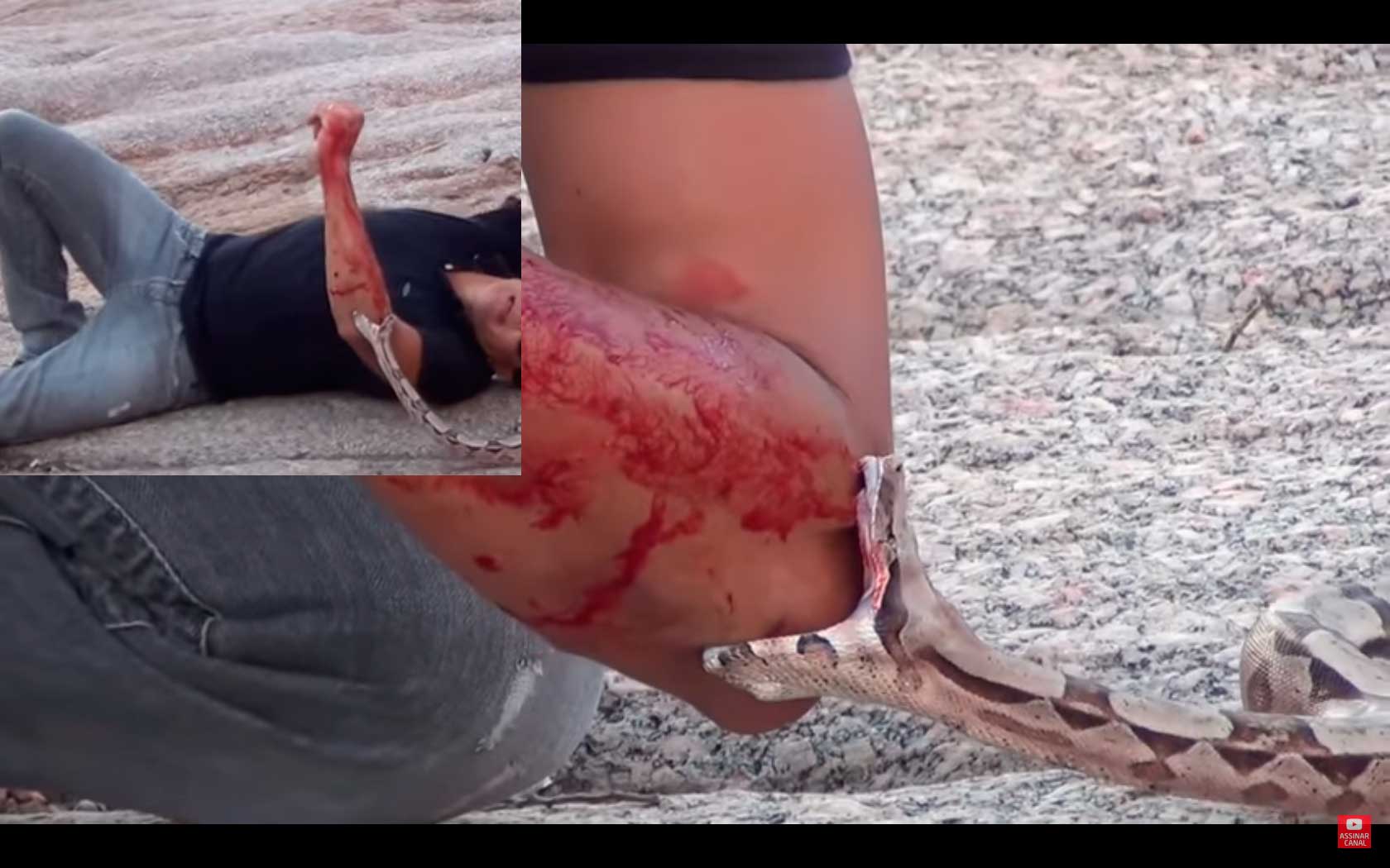 Vídeo retirado de canal famoso registra homem sendo picado por cobra; confira