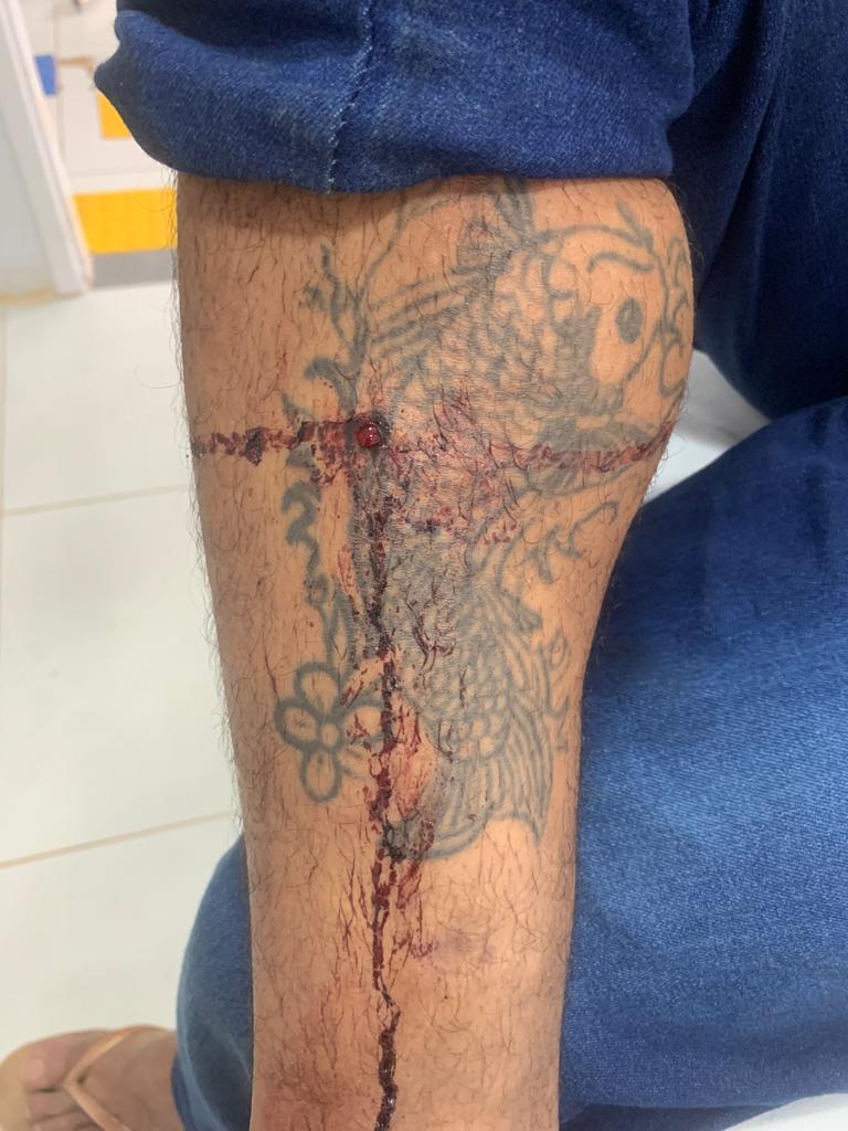 Homem é baleado na perna em via pública em cidade de Mato Grosso