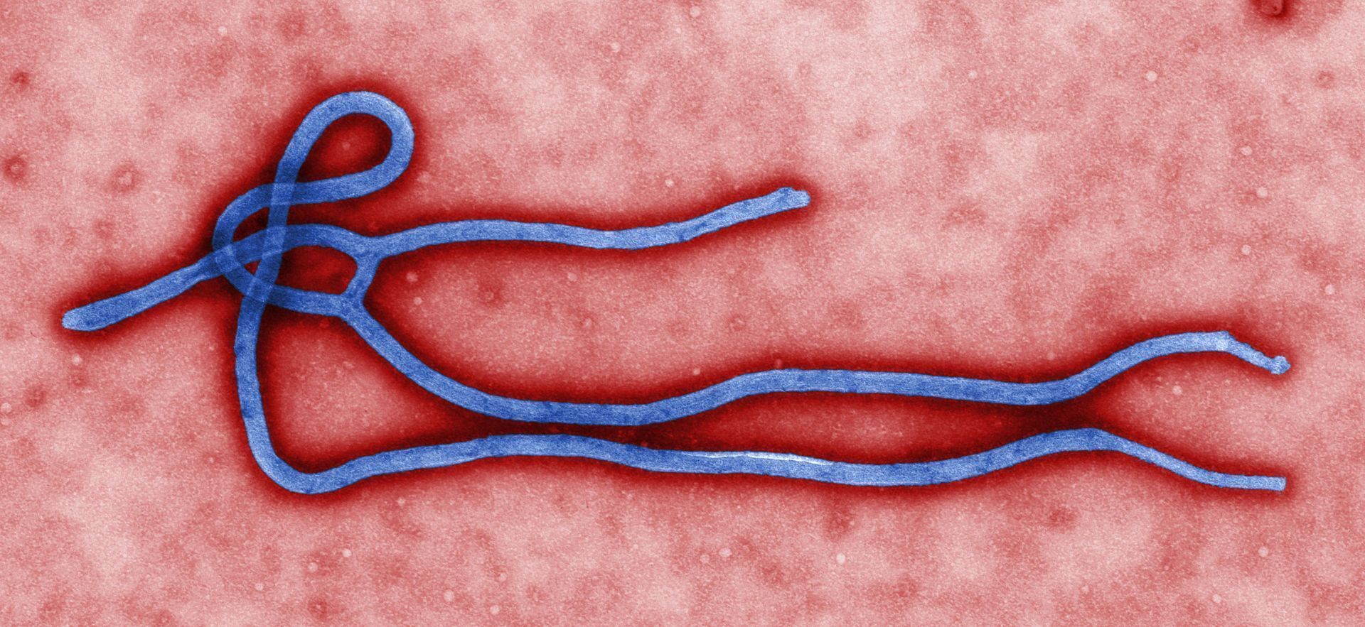 Novo surto de ebola atinge a República Democrática do Congo