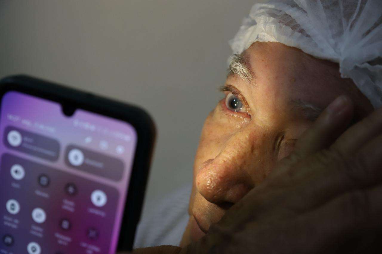 Cirurgias de catarata comecam nesta segunda e pacientes devem ficar atentos aos chamados em Sorriso